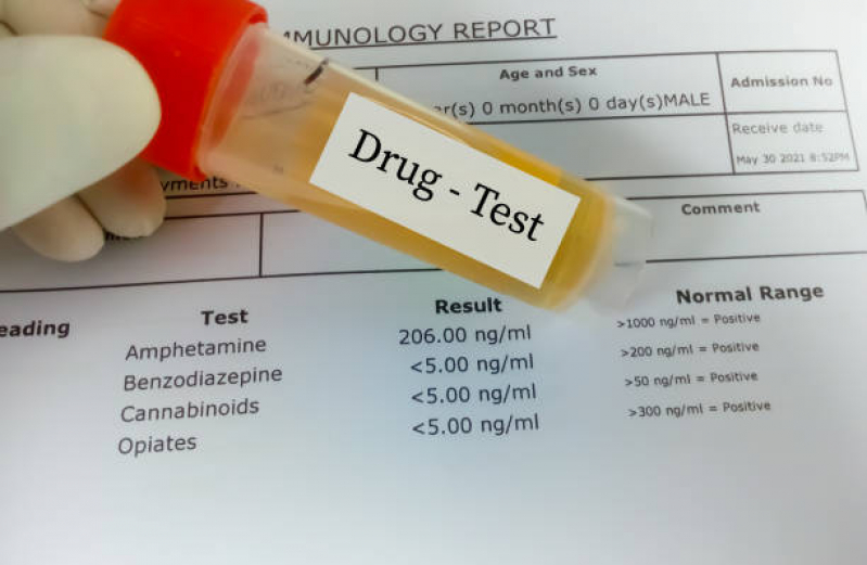 Clínica Que Faz Exame Toxicológico de Urina Setor Econômico de Sobradinho (Sobradinho) - Exame Toxicológico para Habilitação
