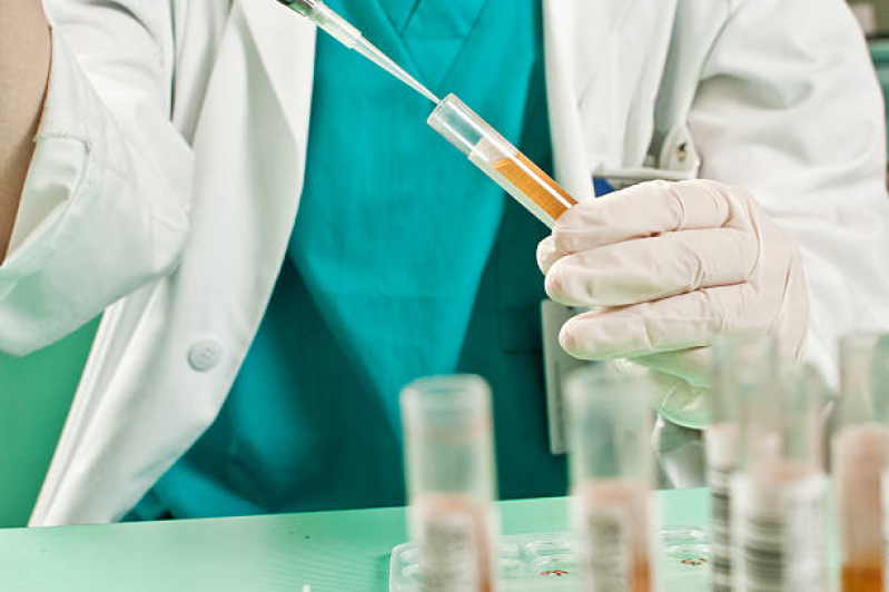 Exame Toxicológico para Detectar Droga Marcar Taguatinga - Exame Toxicológico para Habilitação